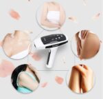 Laserski Epilator